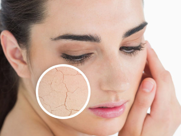 Mẹo chống khô da, môi khi ngồi máy lạnh lâu